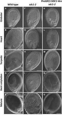 Arabidopsis Serine Decarboxylase 1 (SDC1) in Phospholipid and Amino Acid Metabolism